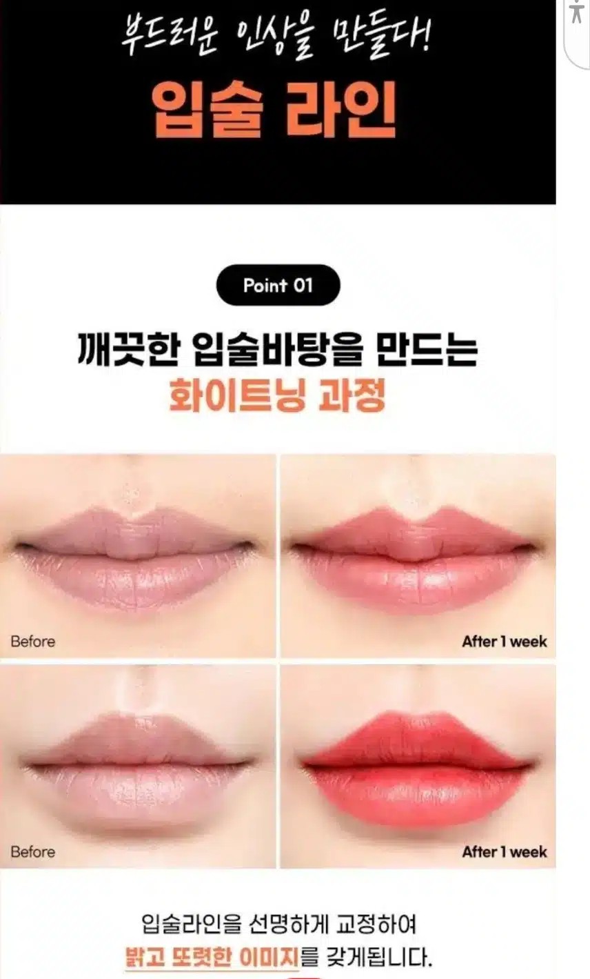 송도비앤미 의원 입술 반영구 후기 추천합니다.