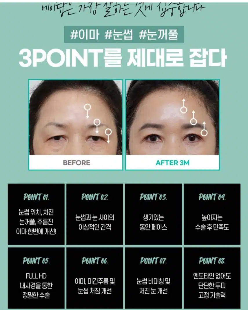  [추천]강남구 에이탑 내시경 이마거상 추천합니다.