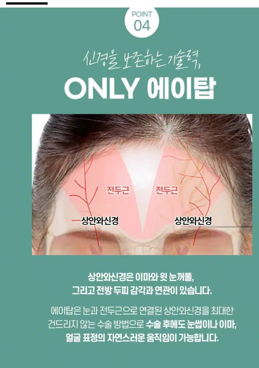  [추천]강남구 에이탑 내시경 이마거상 추천합니다.