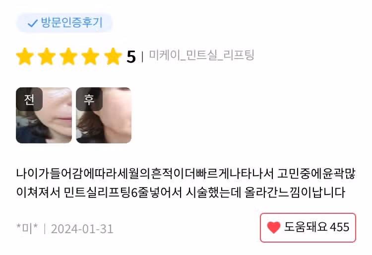미케이의원 눈가 리프팅 민트실 후기 추천해요👍