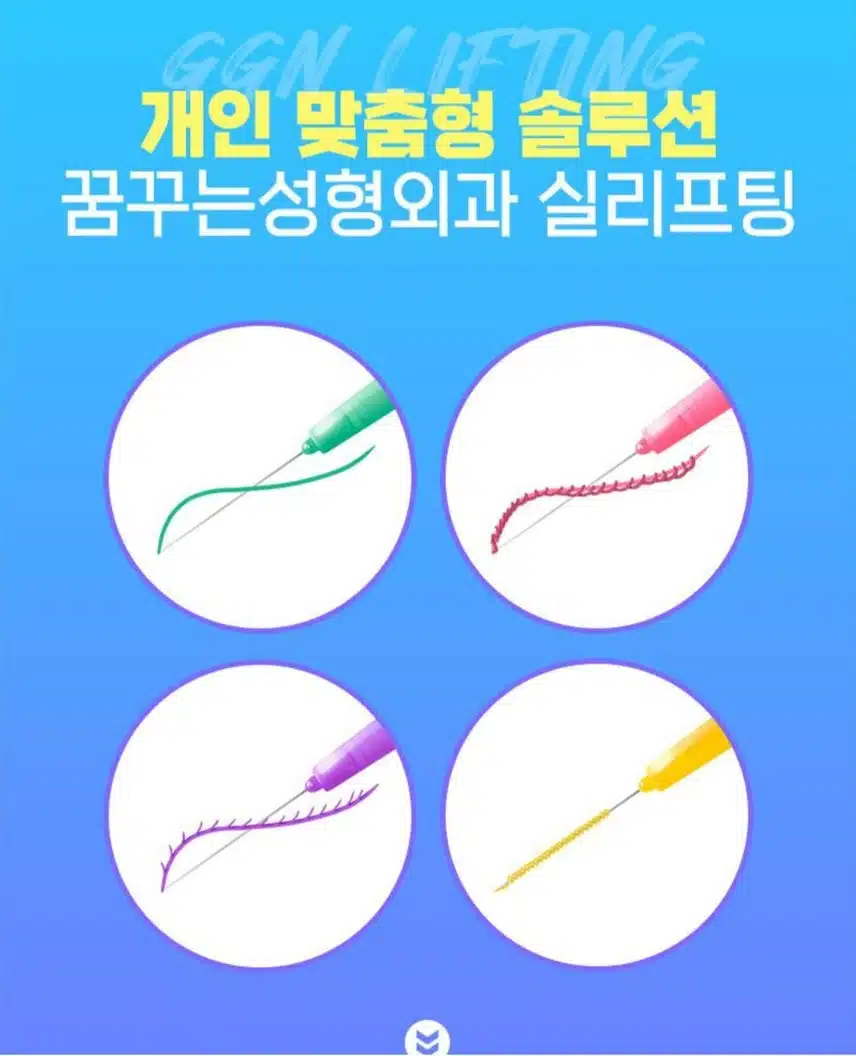 꿈꾸는 성형외과 실리프팅 29만원 후기 추천합니다 