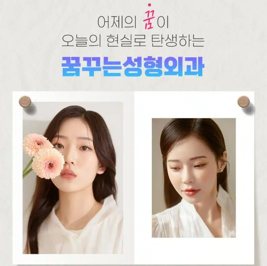 꿈꾸는 성형외과 실리프팅 29만원 후기 추천합니다 
