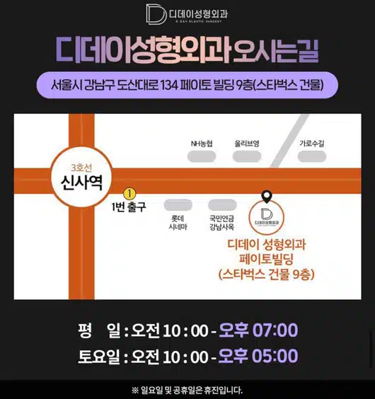 서울 강남구 디데이성형외과의원 콧볼축소 후기 추천할게요!