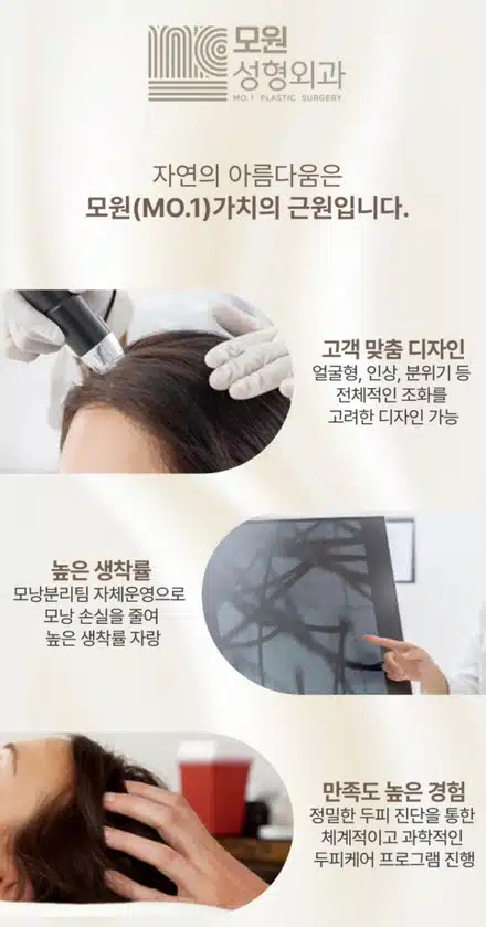 서울 강남구 모원성형외과의원 두피모낭주사 후기 추천합니다