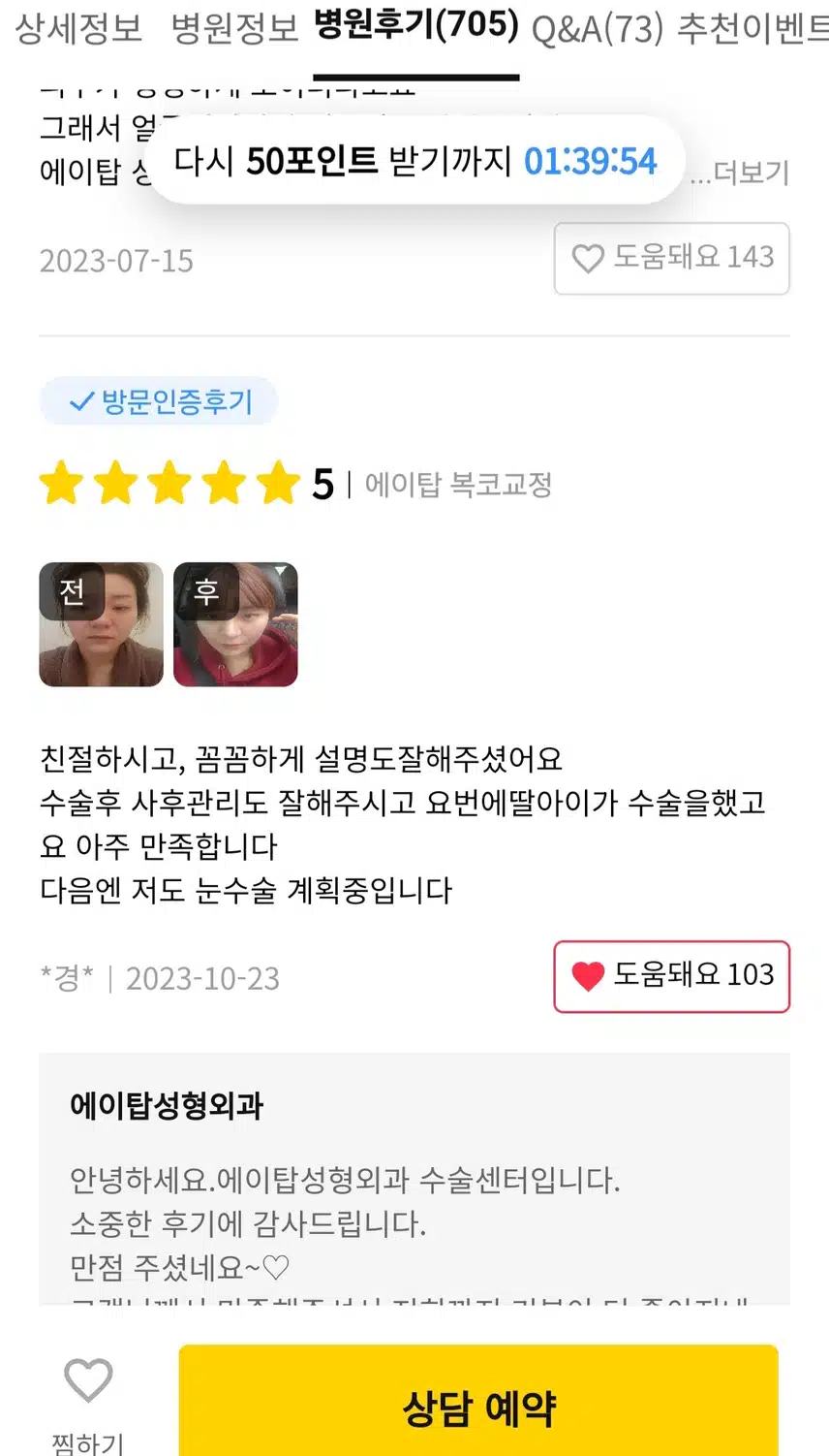 강남구 에이탑성형외과[눈밑지방 재배치]후기 추천해여!