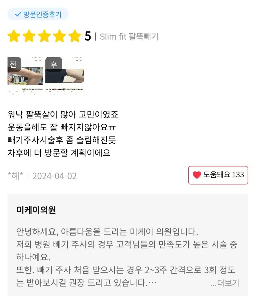 서초구 미케이의원 팔뚝빼기 1회 9,5만원(부가세별도)  후기 