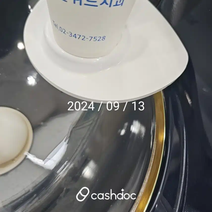 치아가 안 좋아 임플란트 시술로 치과에 간 후기 