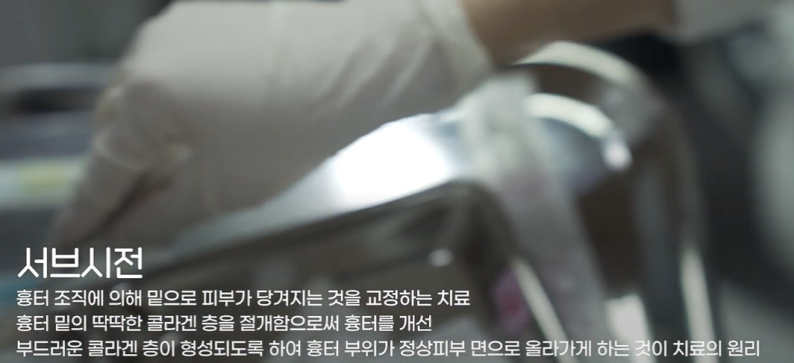 [탑리뷰어4기] 피코프락셀 시술이 넘 받고 싶어요