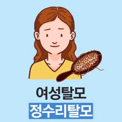 정수리 탈모 초기증상 4가지와 미녹시딜 사용 후기 