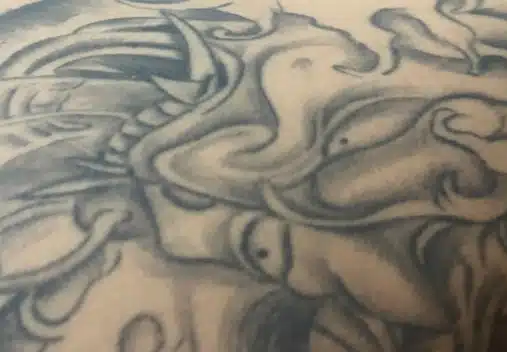 서울 컴포트성형외과 강남구 🐉편안한 문신제거🐉 후기 추천해요!!