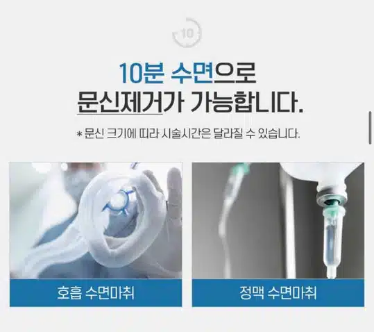 서울 컴포트성형외과 강남구 🐉편안한 문신제거🐉 후기 추천해요!!