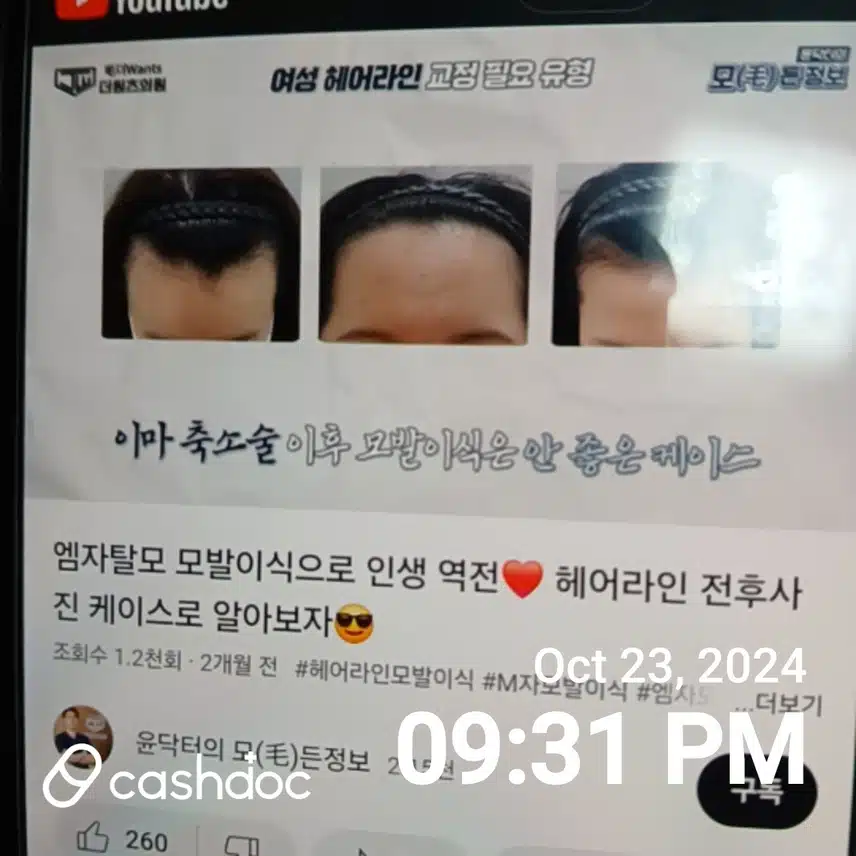 서대문구에 있는  탈모치료 병원인 더원츠  의원
