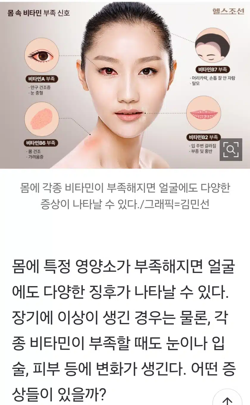 피부 건조할 땐 비타민B6 입술 갈라지면 B2...머리카락 잘 빠질 땐?