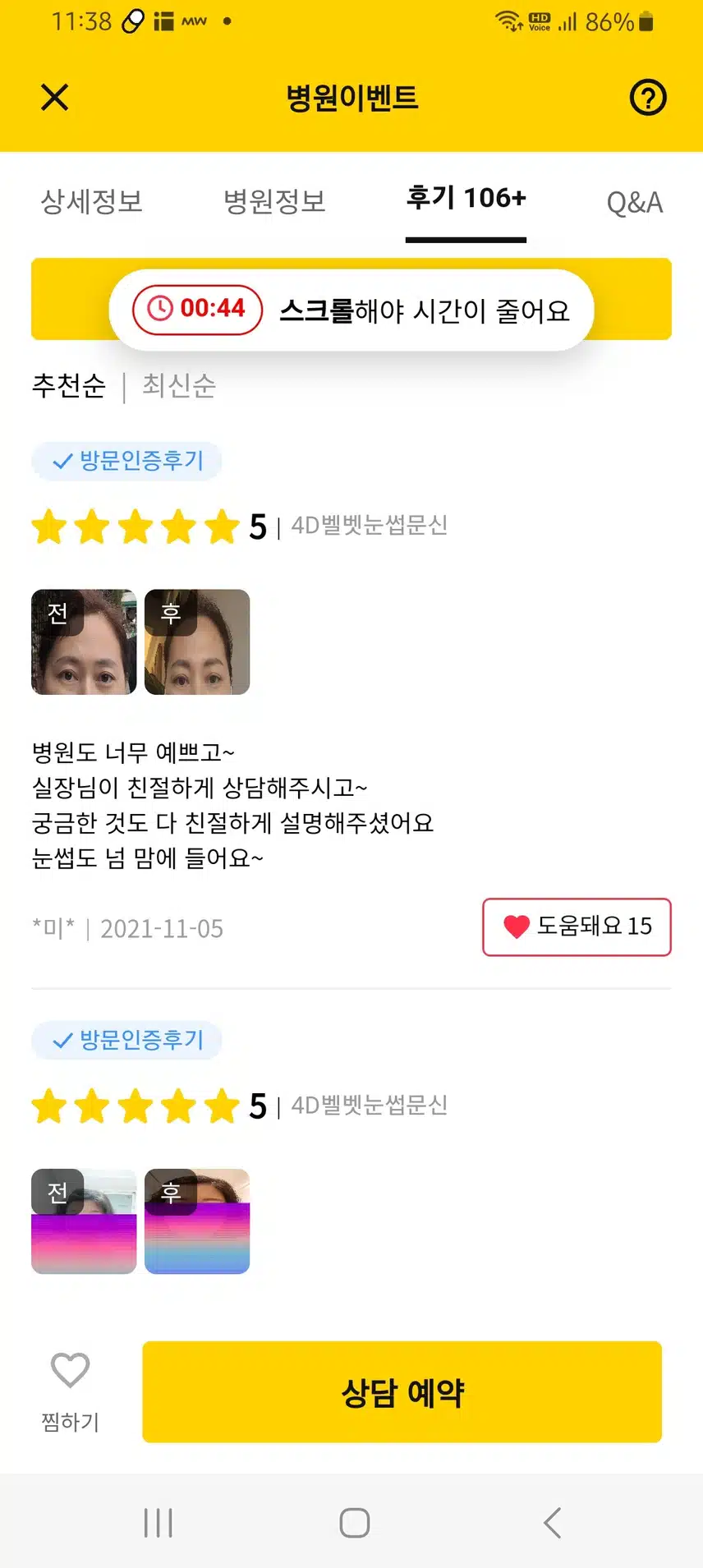 강남구 엔젤미의원 눈썹반영구 7만9천원 후기
