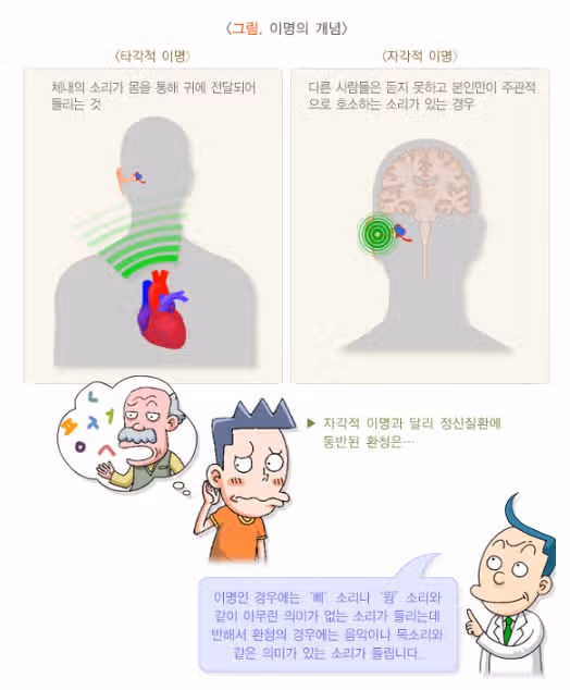 돌발성 난청과 동반된 '이명' 나만의 치료법 4가지 공유