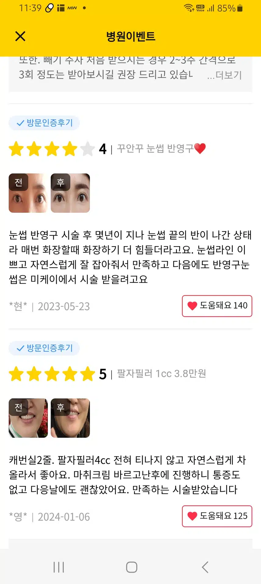 서초 미케이의원 꾸안꾸 눈썹반영구 6.4만원 후기