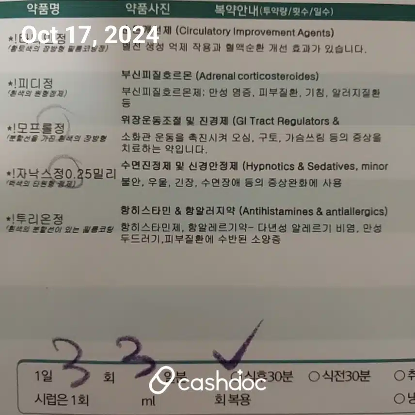 메니에르병 현 상황