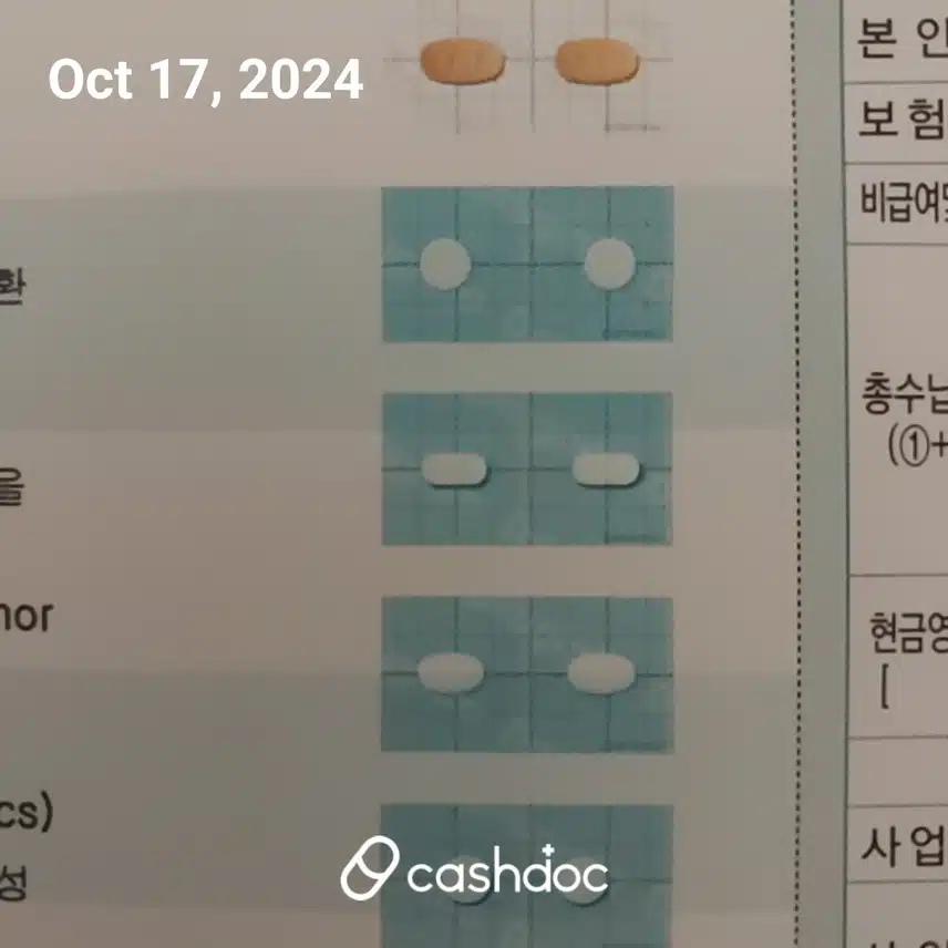 메니에르병 현 상황