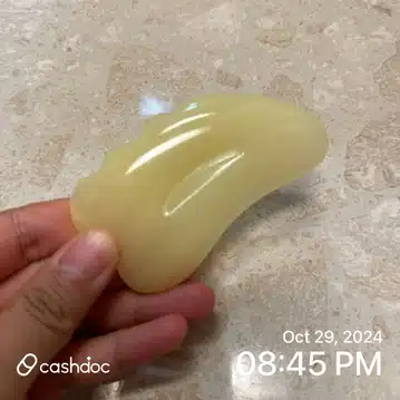 쥐젖이 생긴 부위에 AHA크림,마사지을 열심히 바르고 있어요. 