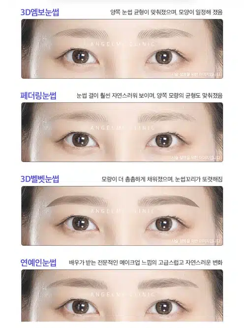 [강남 엔젤미의원 눈썹반영구 7만 9천원] 후기 추천