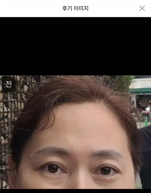 [강남 엔젤미의원 눈썹반영구 7만 9천원] 후기 추천