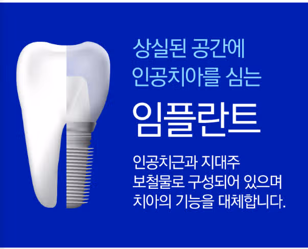 서울 강남구 클리어 국산 덴티움 임플란트💙 후기 추천해요