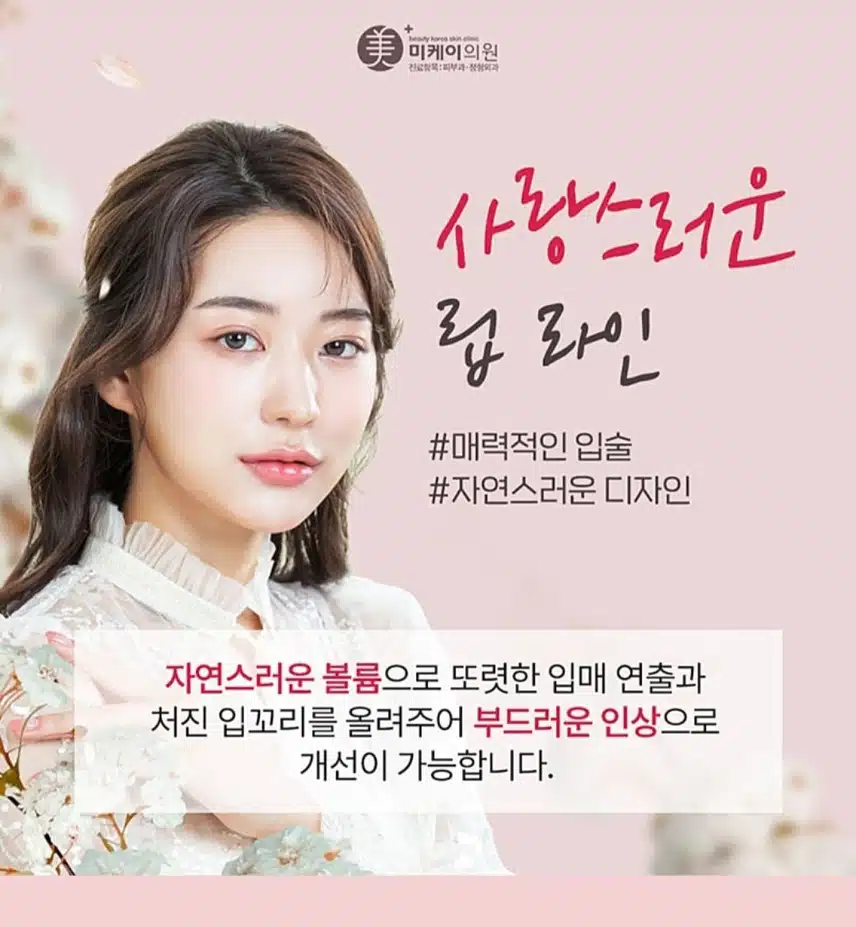 서초구 미케이의원 입술필러 9.5만원 후기