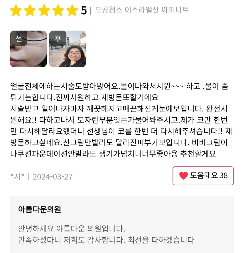 광진구 아름다운의원 아피니트 5.8만원 후기 추천합니다 