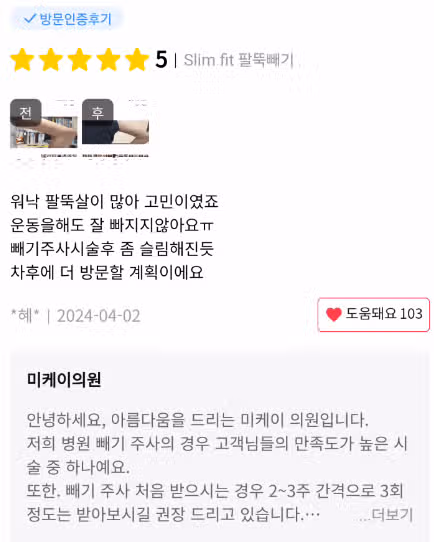 서초구 미케이의원 빼기주사로 슬림해진 팔뚝 후기 공유해요