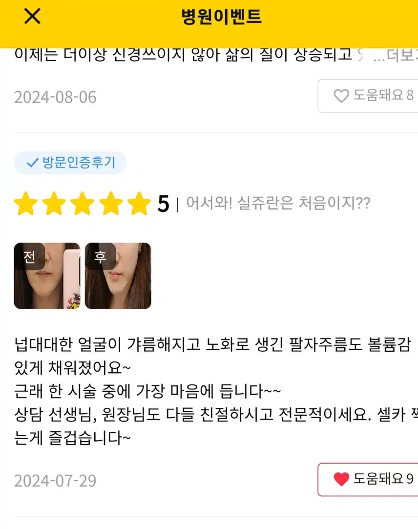 강남구 어서와! 실주란은 처음이지? 팔자주름 후기 공유