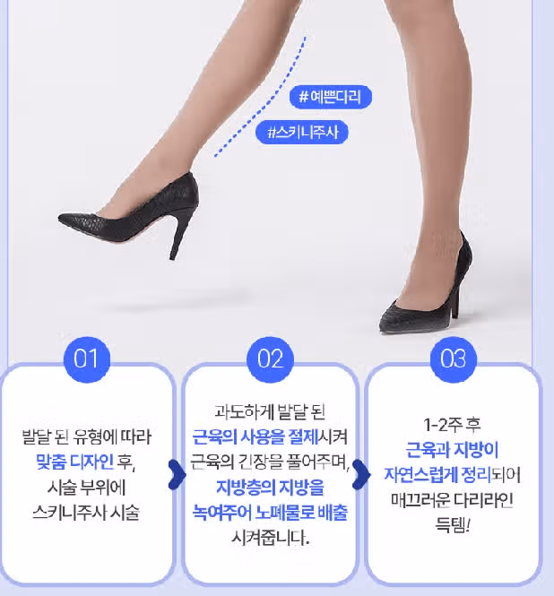 서울시 서초구 미케이 종아리 주사  9.9만원 후기