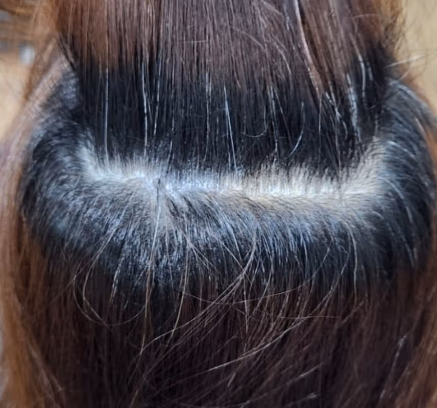 [질문]젊은 나이인데 새치가 왜 생길까요?
