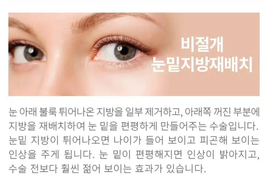 눈밑 지방재배치 수술 빋고싶어요