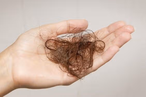 (질문) 머리카락이 점점 많이 빠지네요 관리 어떻게 해주고 계세요?