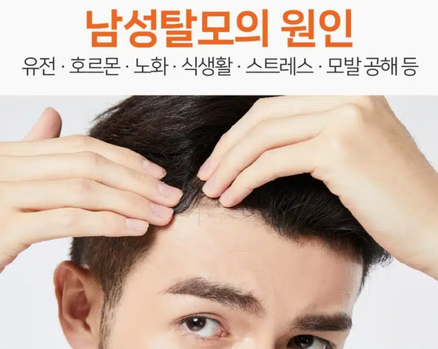 탈모 때문에 걱정이네요.
