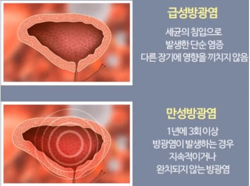 방광염으로 고생하다 병원에 방문