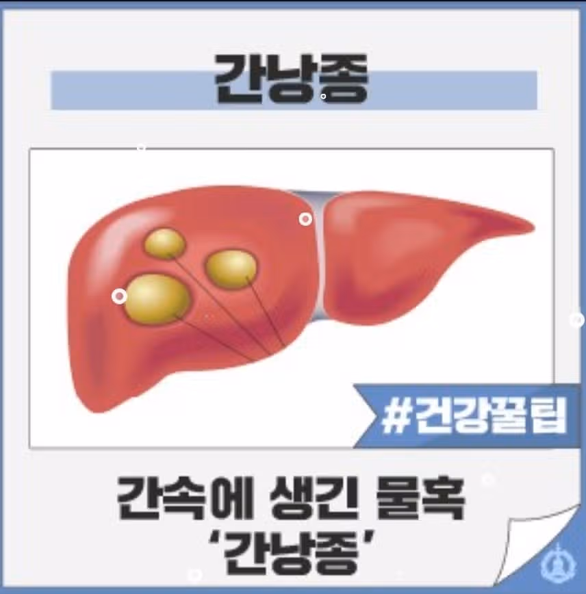 고민(간 때문이~야! 피곤은 간때문이야~! )
