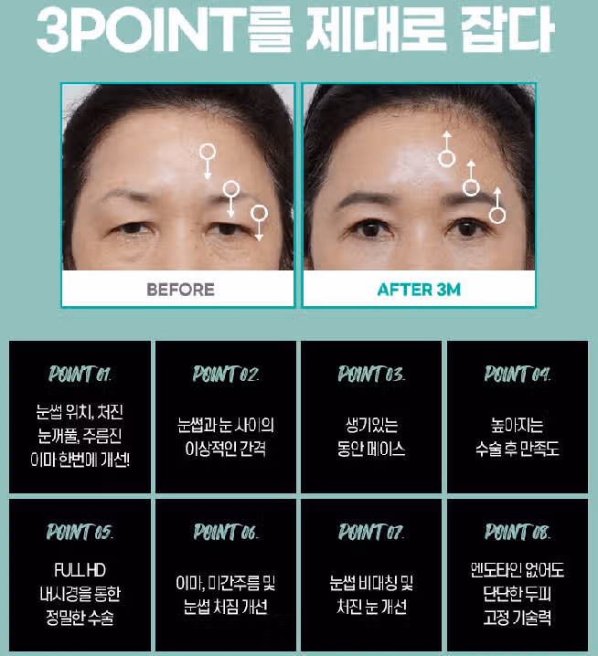 서울시 강남구 에이탑 내시경 이마거상 190만원 후기