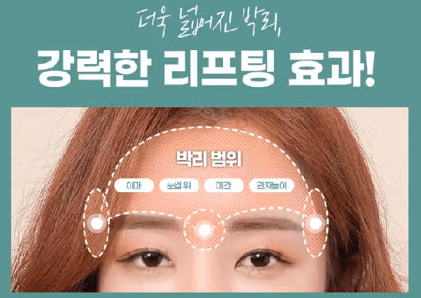 서울시 강남구 에이탑 내시경 이마거상 190만원 후기