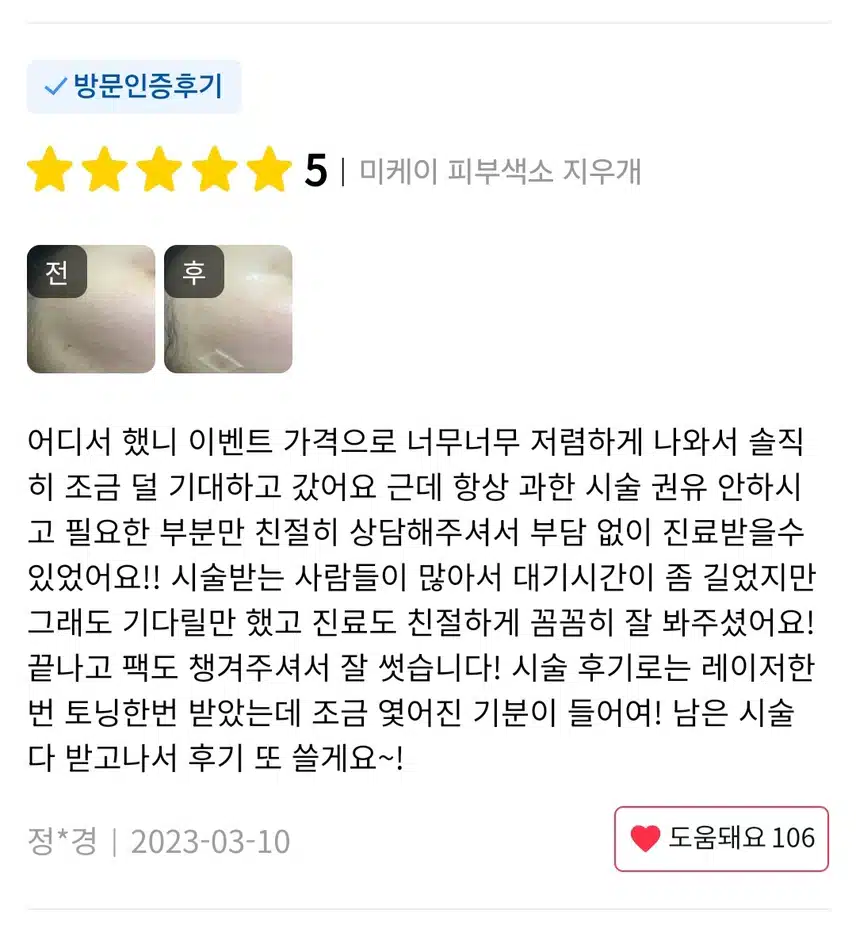 서초 피부색소 지우개 에이톤/토닝 9.9만원 후기