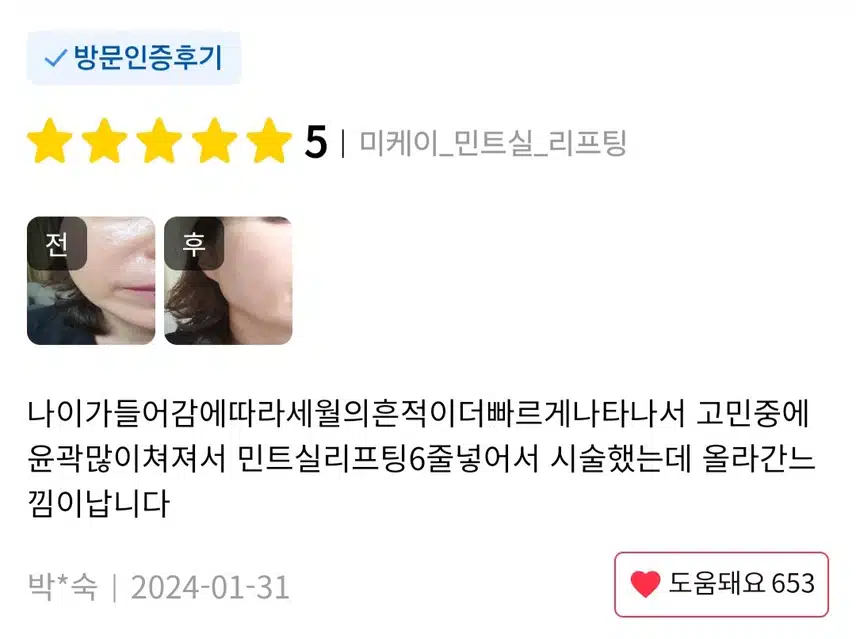 서초구 미케이 민트실 리프팅 한줄당 4.9만원 후기 추천합니다.