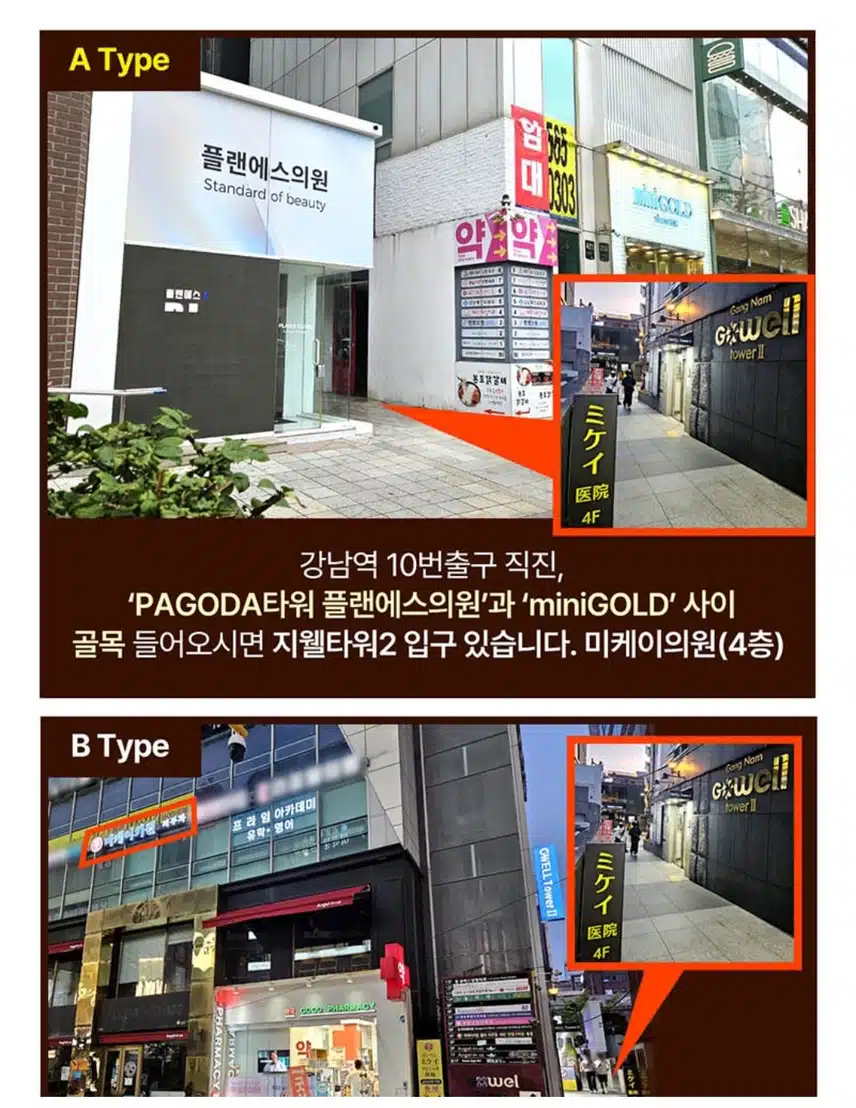 서초구 미케이 민트실 리프팅 한줄당 4.9만원 후기 추천합니다.