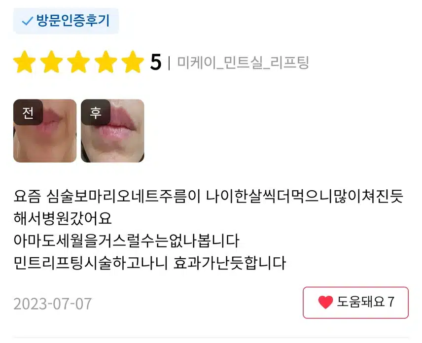 서초구 미케이 민트실 리프팅 한줄당 4.9만원 후기 추천합니다.