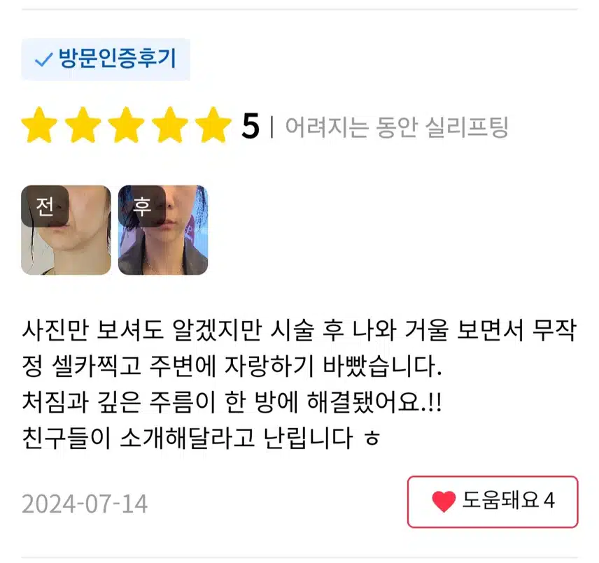 강남구 팽팽의원 동안실리프팅 4.1만원 후기