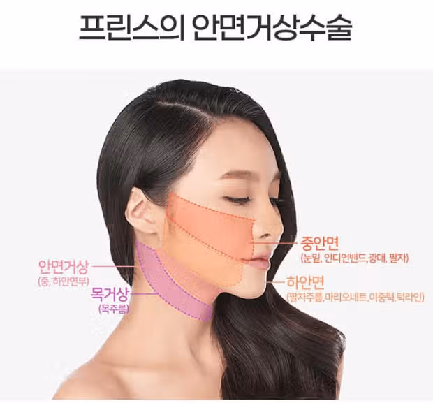 서울시 강남구 추가금❎♥미니거상 3종(거상+지흡) 후기