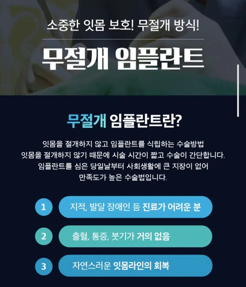 강남구 킹콩치과의원 임플란트 29만원 후기 공유