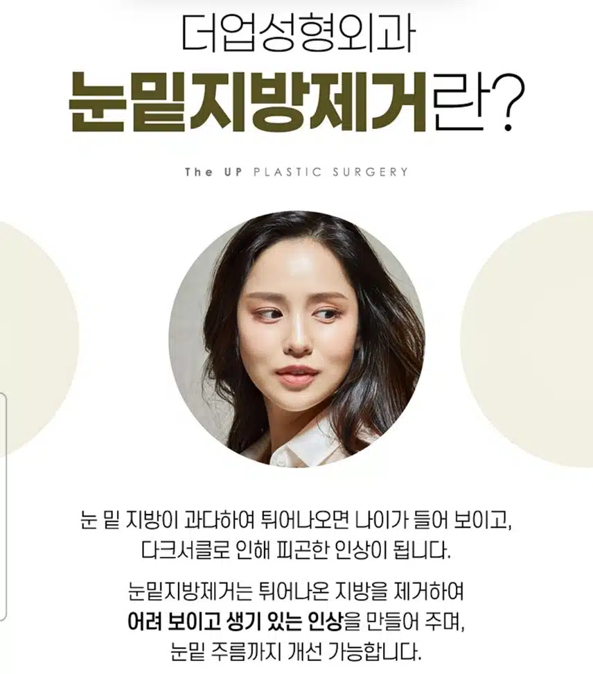 서초구 더업성형외과 밝고 화사한 눈밑지방제거39만원 후기