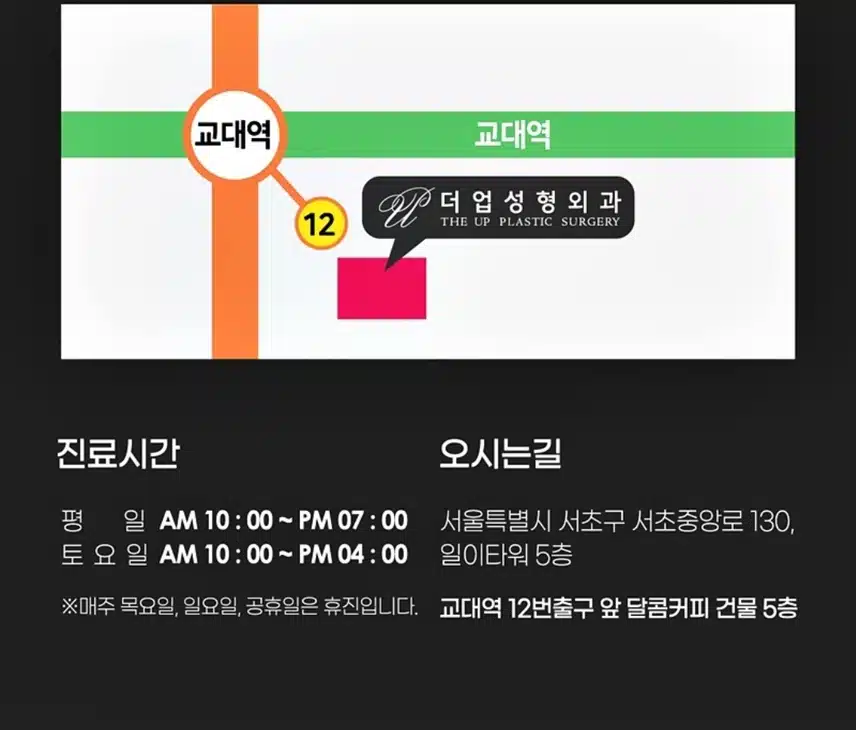 서초구 더업성형외과 밝고 화사한 눈밑지방제거39만원 후기