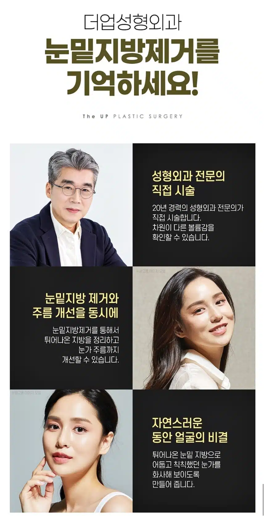 서초구 더업성형외과 눈밑지방제거39만원 후기공유해요