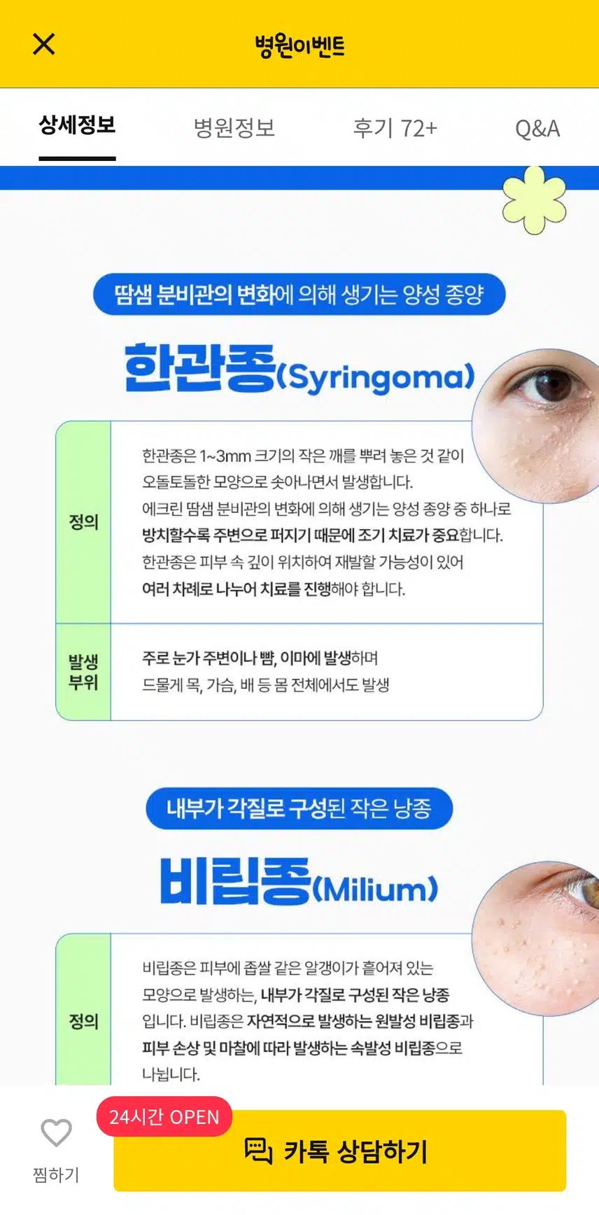 서울 서초구의 한관종 비립종 쥐젖제거 후기